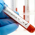 El estado de Nueva York tiene más casos de coronavirus que cualquier país