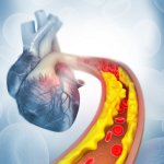 “¿Cómo puedo reducir naturalmente mi colesterol LDL?”
