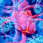 ¿Qué es la miocarditis y qué relación tiene con la vacuna COVID?