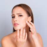 ¿Las pastillas anticonceptivas son buenas para combatir el acné?