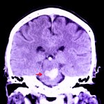 ¿Quieres cuidar tu cerebro? El silencio podría ser la clave